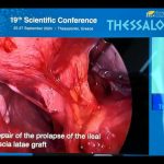 Fundación Valle del Lili presente en el Congreso Europeo de Coloproctología (2)