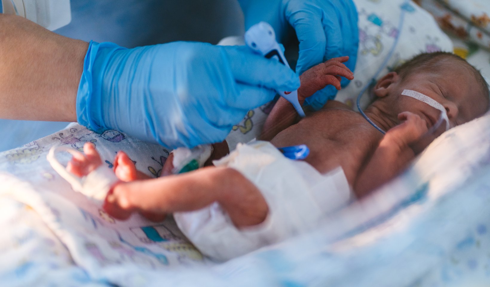Cuidado intensivo neonatal