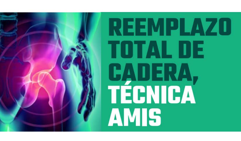 reemplazo-total-de-cadera.jpg