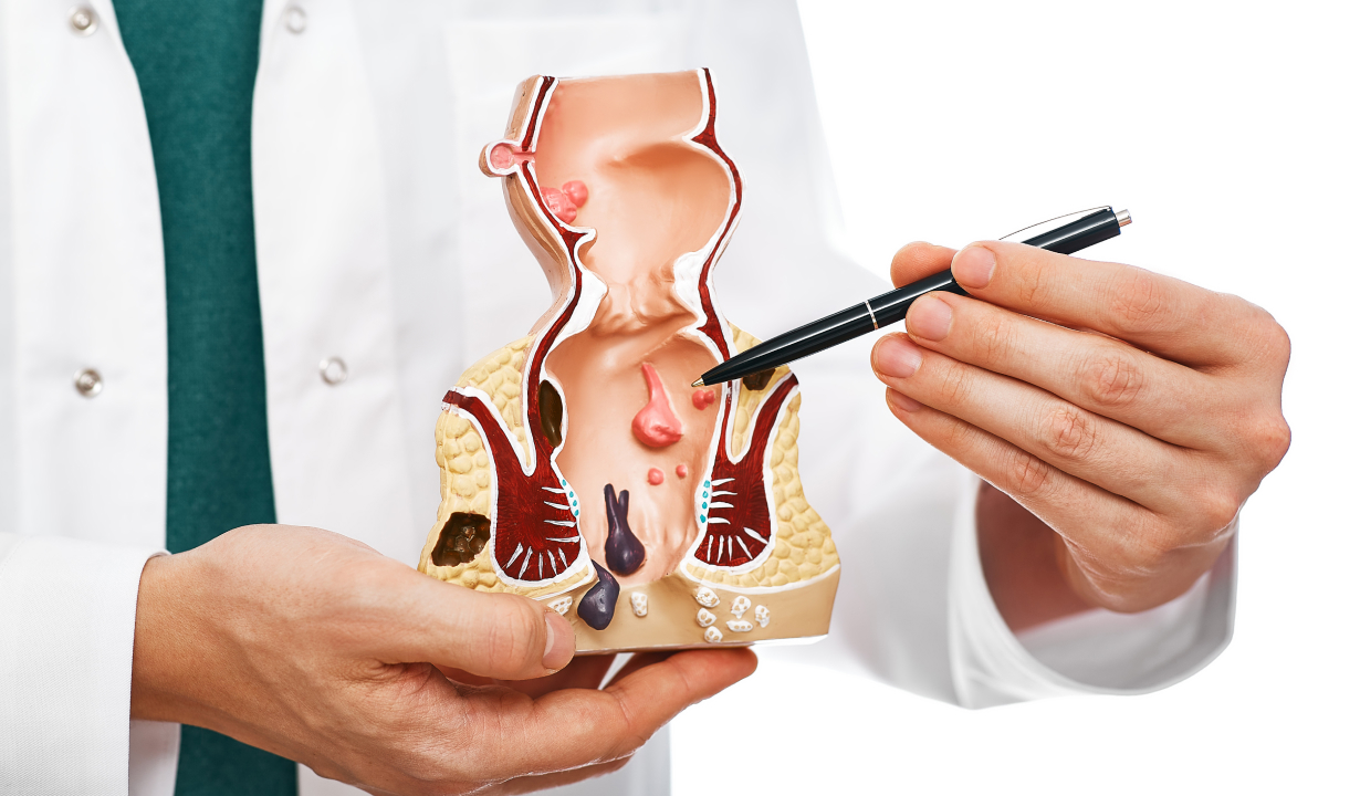 Diagrama o ilustración del esfínter anal y el recto.